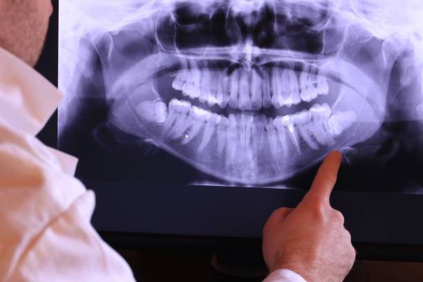 Best Emergency Dental Care for Broken or Chipped Teeth in Northlake, SC